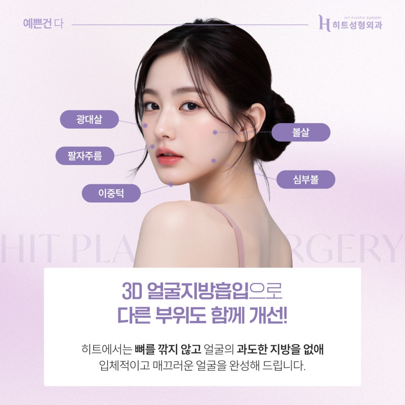 [히트성형외과] 이중턱 지방흡입 후 어려 보이는 이유는? 사진 5
