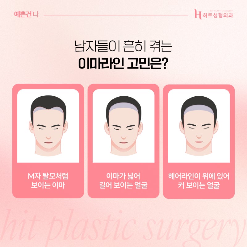 [히트성형외과] 남성형 얼굴에 맞춘 이마축소를 통해! 사진 3