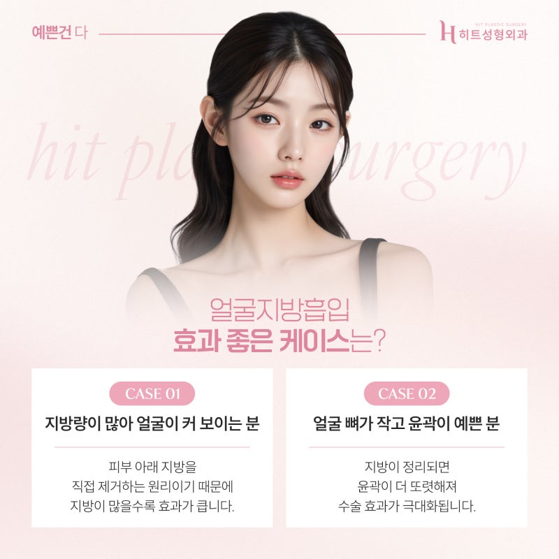 [히트성형외과] 얼굴지방흡입 후 붓기 언제 빠질까요? 사진 4