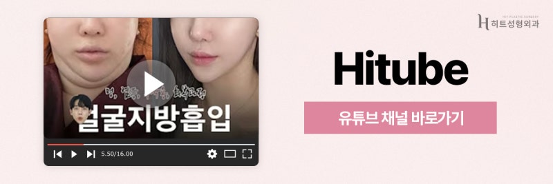 [히트성형외과] 얼굴지방흡입 후 붓기 언제 빠질까요? 사진 8