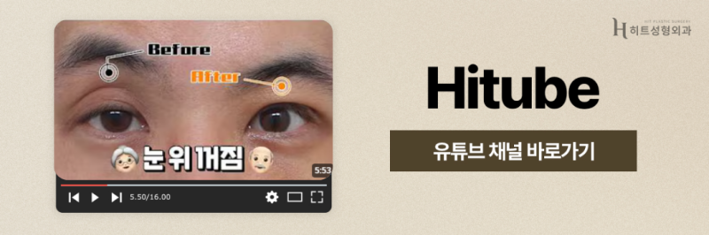 [히트성형외과] 처진 눈꺼풀 때문에 피곤해 보인다면? 사진 8