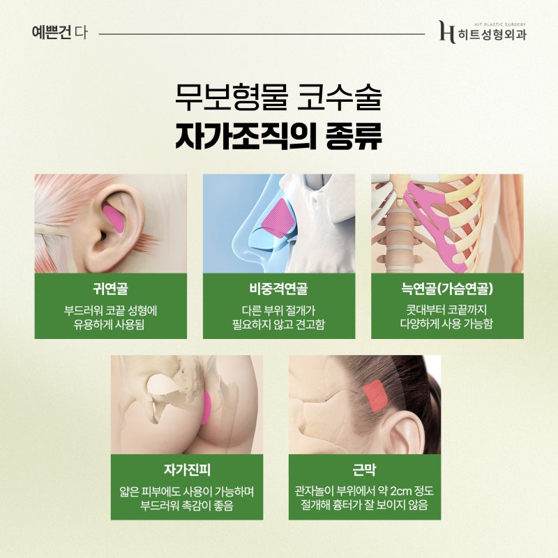 [히트성형외과] 무보형물 코성형, 나에게도 맞을까? 사진 3