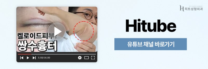 [히트성형외과] 쌍꺼풀 수술 성공률 높이는 타이밍! 사진 8