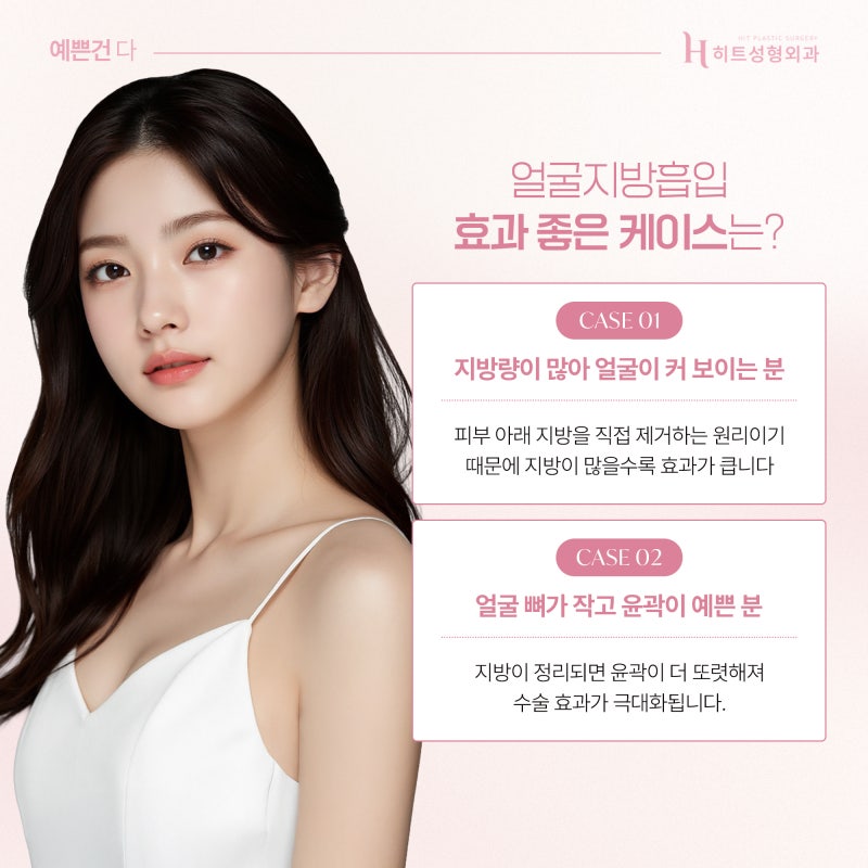 [히트성형외과] 얼굴지방흡입 원하는 부위만 가능할까? 사진 4