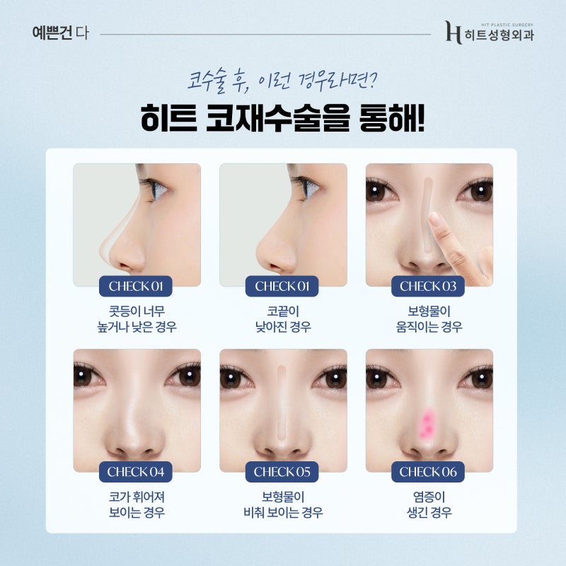 [히트성형외과] 코재수술, 최소 대기 기간이 필요한 이유는? 사진 3