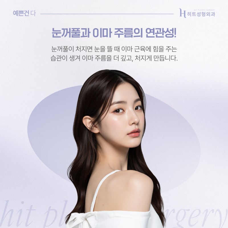 [히트성형외과] 내시경 이마거상 후 눈매변화는?