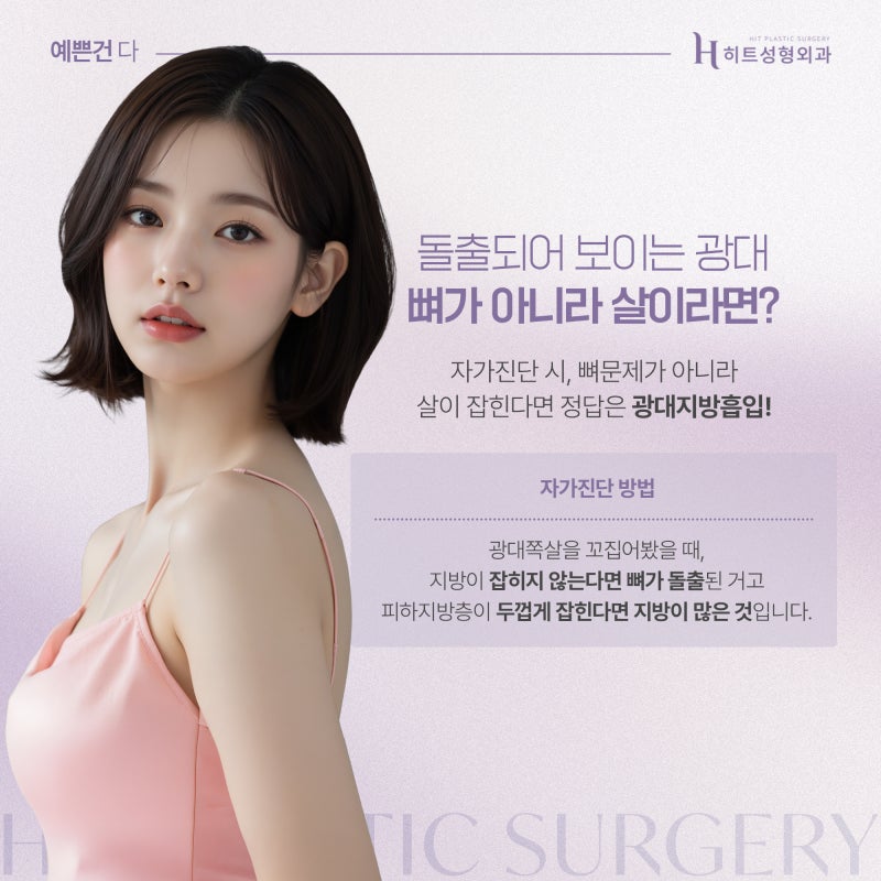 [히트성형외과] 광대뼈 아닌데 얼굴 커보인다면? 사진 3