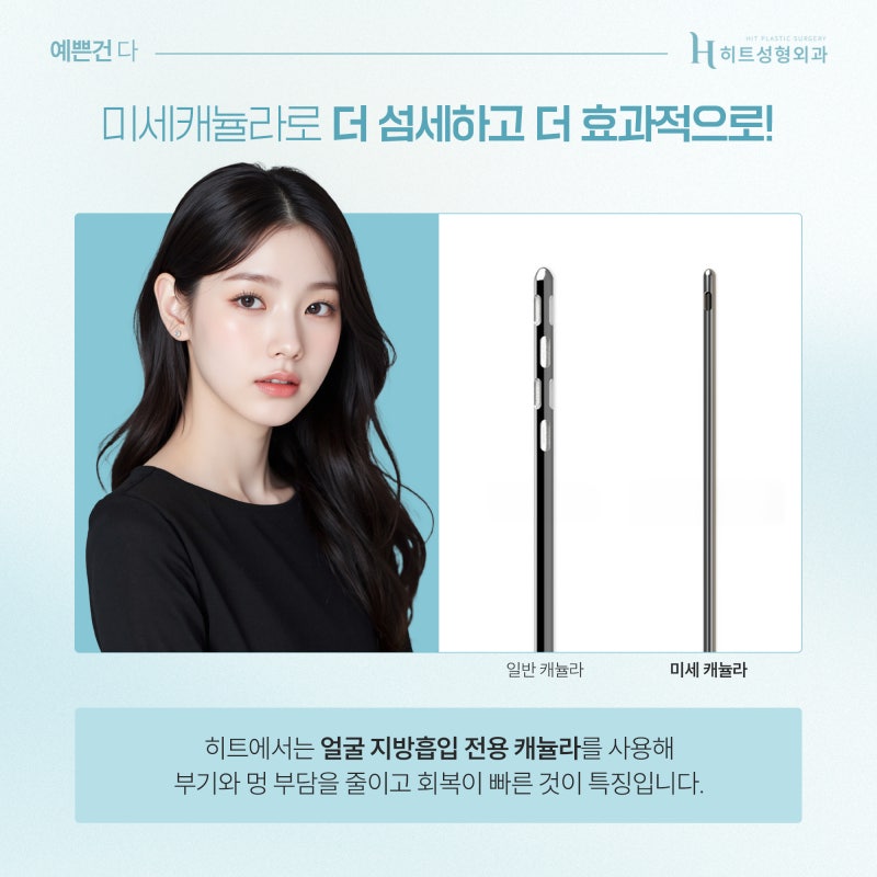 [히트성형외과] 얼굴지방흡입 부작용, 흔한 오해와 진실 사진 6