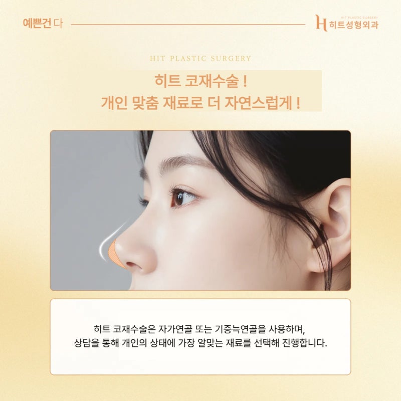 [히트성형외과] 코끝 처짐, 재수술로 개선하는 방법! 사진 4
