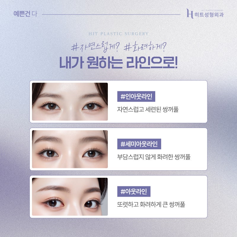 [히트성형외과] 부분절개 쌍꺼풀! 오래가는 시원한 눈매로 사진 3