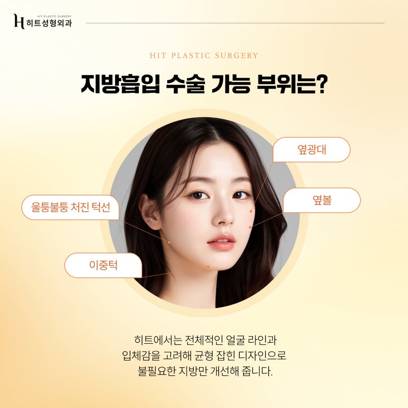 [히트성형외과] 지방흡입+실리프팅으로 얼굴살 고민 끝! 사진 3