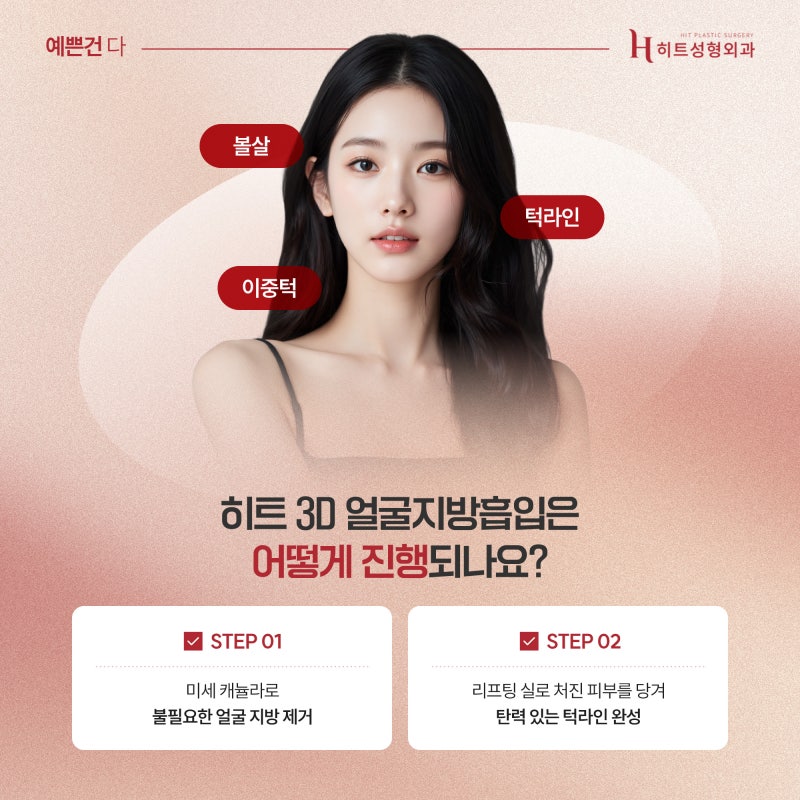[히트성형외과] 이중턱 고민, 지방흡입으로 자신감 찾기! 사진 4