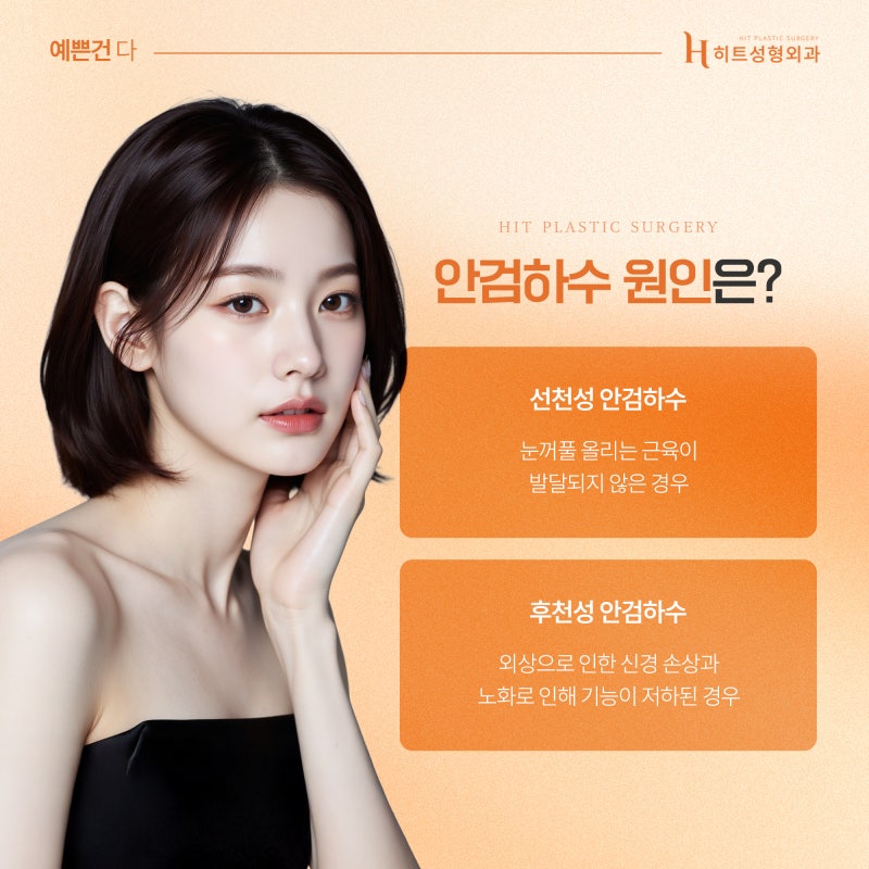 [히트성형외과] 눈 뜨는 힘이 부족하다면 혹시 안검하수? 사진 3