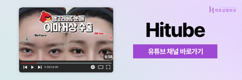 [히트성형외과] 이마축소술, 누가 받을 수 있을까요? 대상 총정리! 사진 8