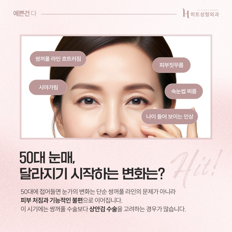 [히트성형외과] 50대 눈성형, 쌍꺼풀 대신 상안검이 필요한 이유