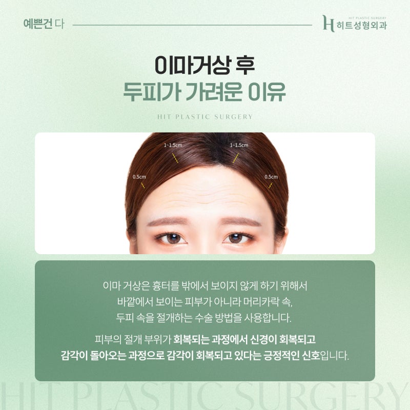 [히트성형외과] 이마거상 후 두피 가려움, 왜 생길까요?