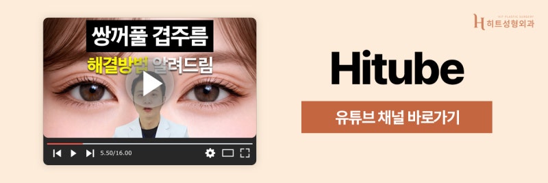 [히트성형외과] 졸려 보이는 눈, 안검하수 자가진단 방법은? 사진 8