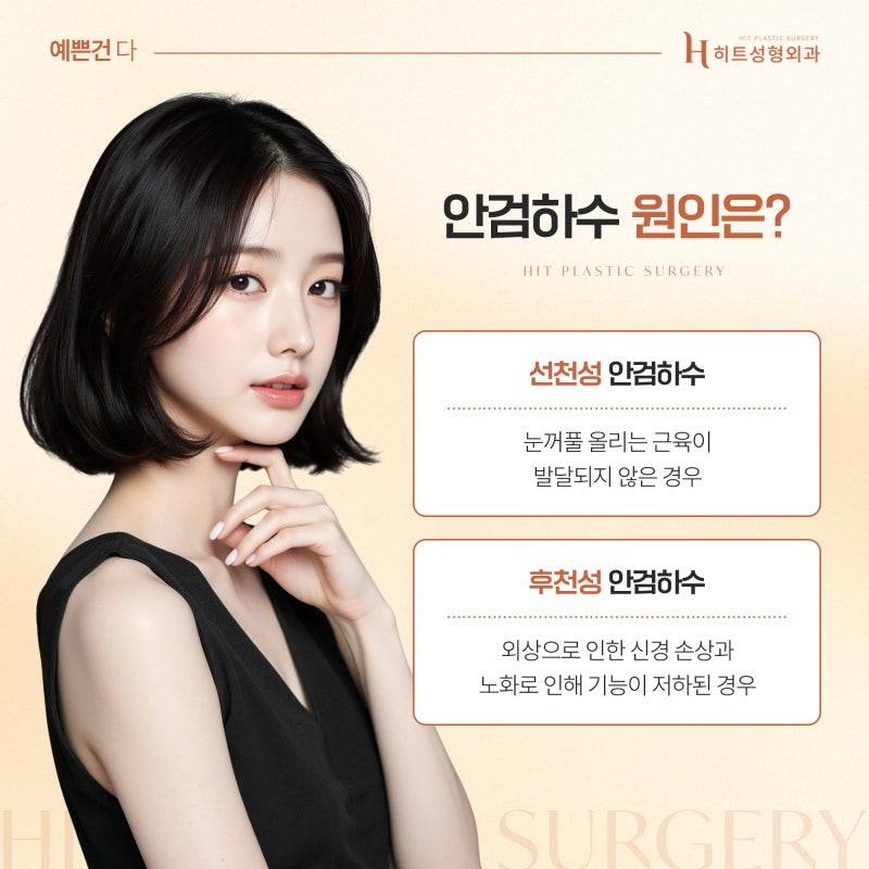 [히트성형외과] 졸려 보이는 눈, 안검하수 자가진단 방법은? 사진 4