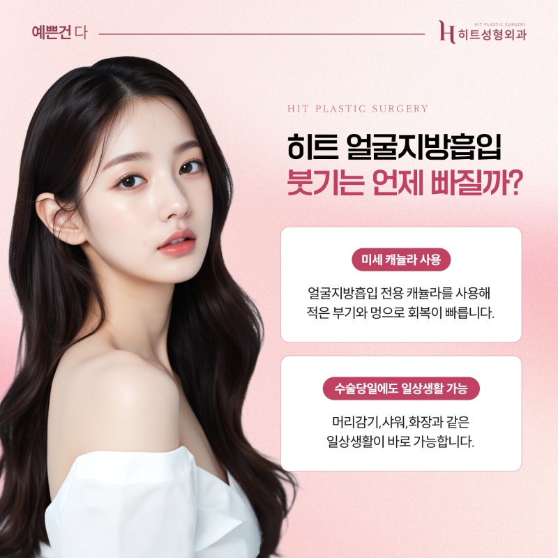 [히트성형외과] 얼굴지방흡입 효과 언제부터 보일까요? 사진 3