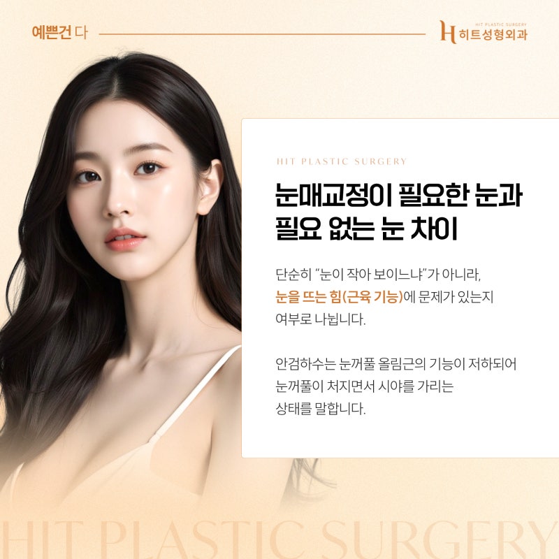 [히트성형외과] 눈매교정이 필요한 눈 vs 필요 없는 눈 차이