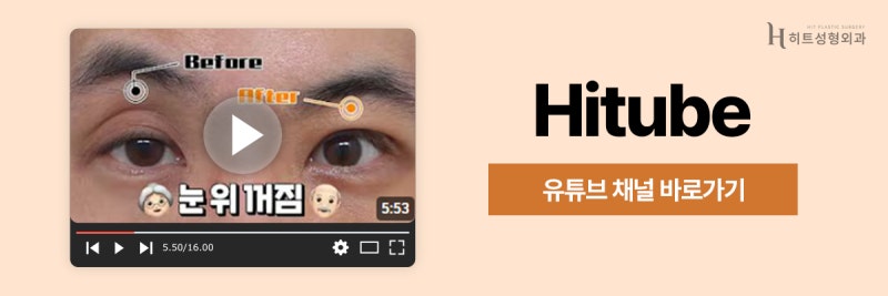 [히트성형외과] 눈매교정이 필요한 눈 vs 필요 없는 눈 차이 사진 8