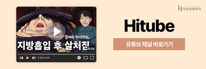 [히트성형외과] 얼굴지방흡입, 이중턱만 제거해도 달라질까요? 사진 8