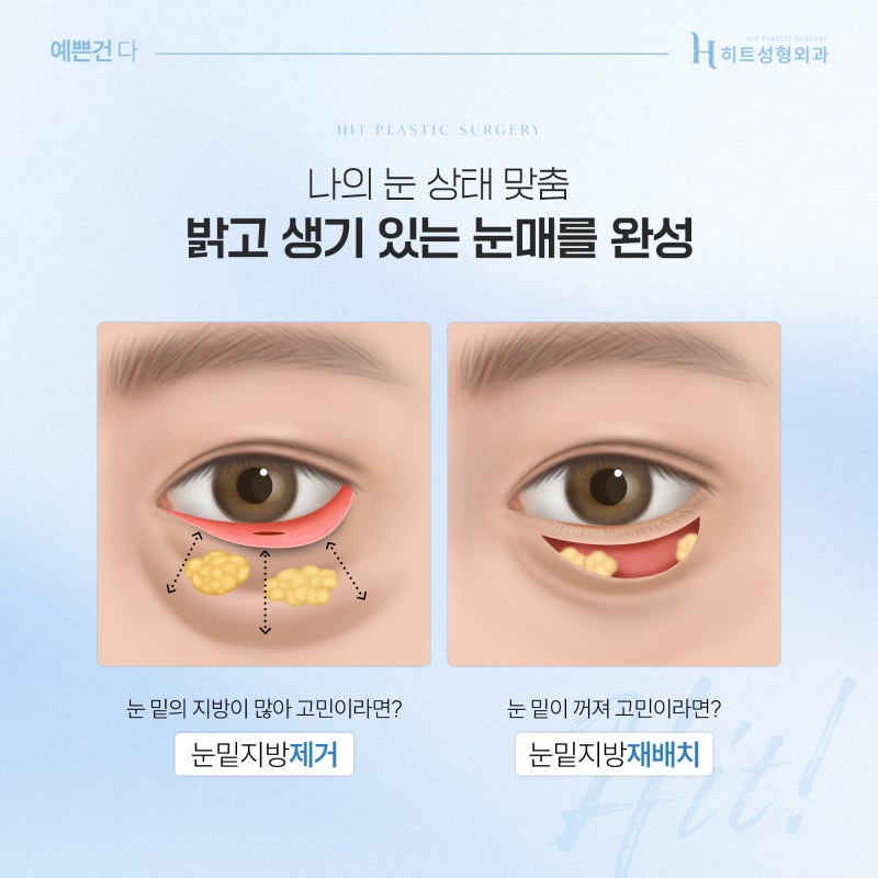 [히트성형외과] 피곤해 보이는 인상, 눈밑지방재배치로 개선될까? 사진 3