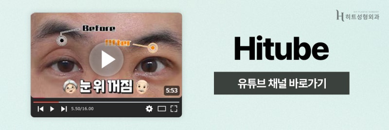 [히트성형외과] 눈 밑 꺼짐 vs 지방 돌출, 어떤 수술이 필요할까? 사진 8