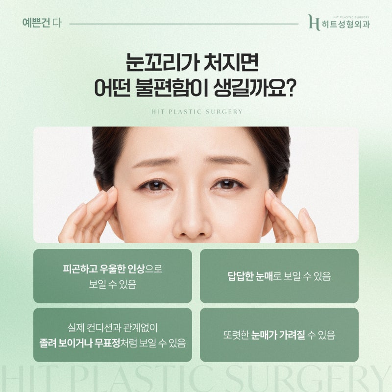 [히트성형외과] 눈꼬리 처짐 개선, 어떤 방법이 효과적일까?