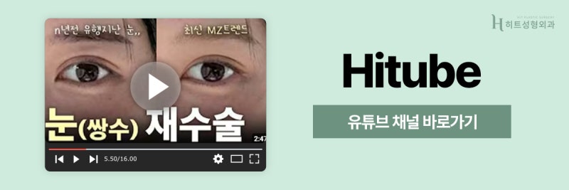 [히트성형외과] 눈꼬리 처짐 개선, 어떤 방법이 효과적일까? 사진 8