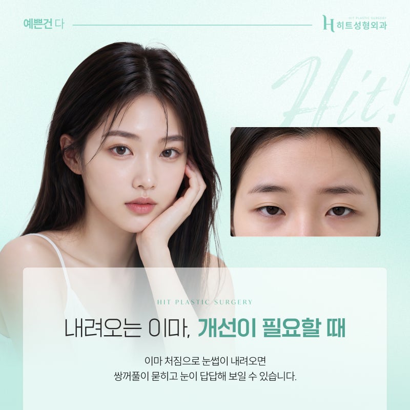 [히트성형외과] 이마거상술 후 감각 저하, 언제 회복될까?