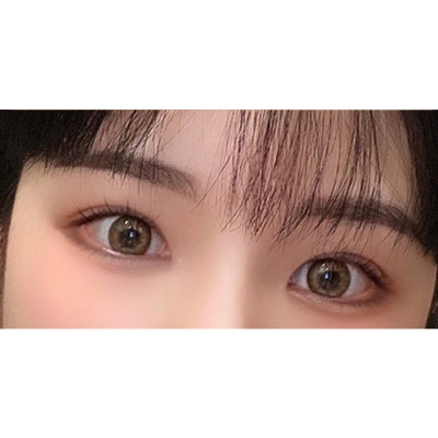 쌍꺼풀 겹주름이 눈성형을 하면? [히트성형외과] 사진 5