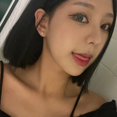 매부리코와 복코 동시 개선! [히트성형외과 코성형] 사진 7