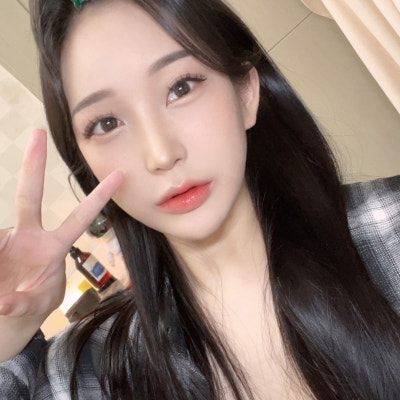 비순각교정&화살코 교정 2편 [히트성형외과 코성형] 사진 8