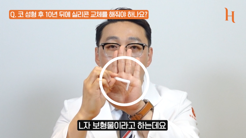 코성형 후 코 실리콘 교체만 하고 싶다면? 사진 3