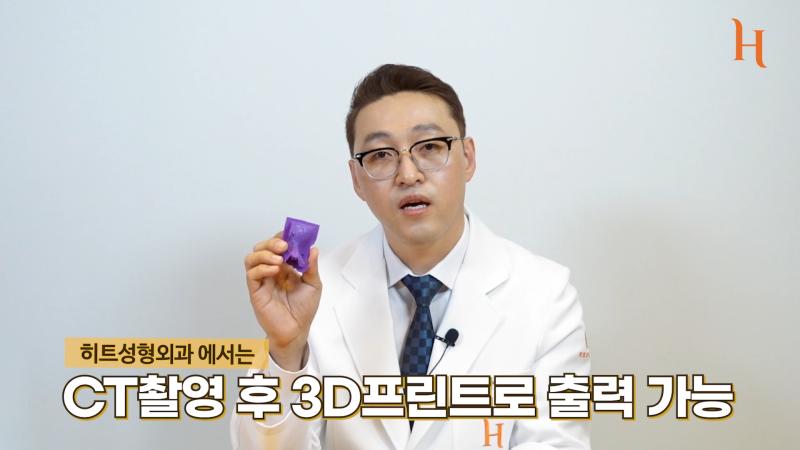 미간콧대만 교정해도 되는 경우 with 히트성형외과 사진 3