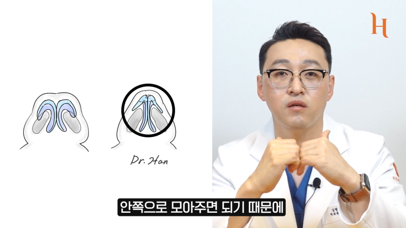 코끝 연골묶기 수술방법 이게 뭐죠! 사진 6