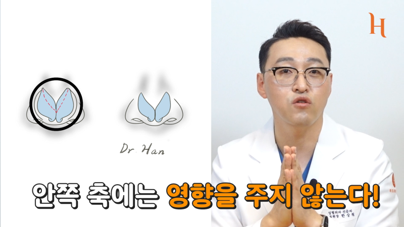 코끝 연골묶기 수술방법 이게 뭐죠! 사진 5