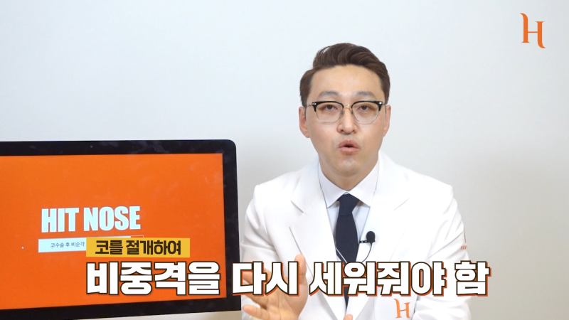 비순각교정 중요한 이유 [히트성형외과] 사진 4
