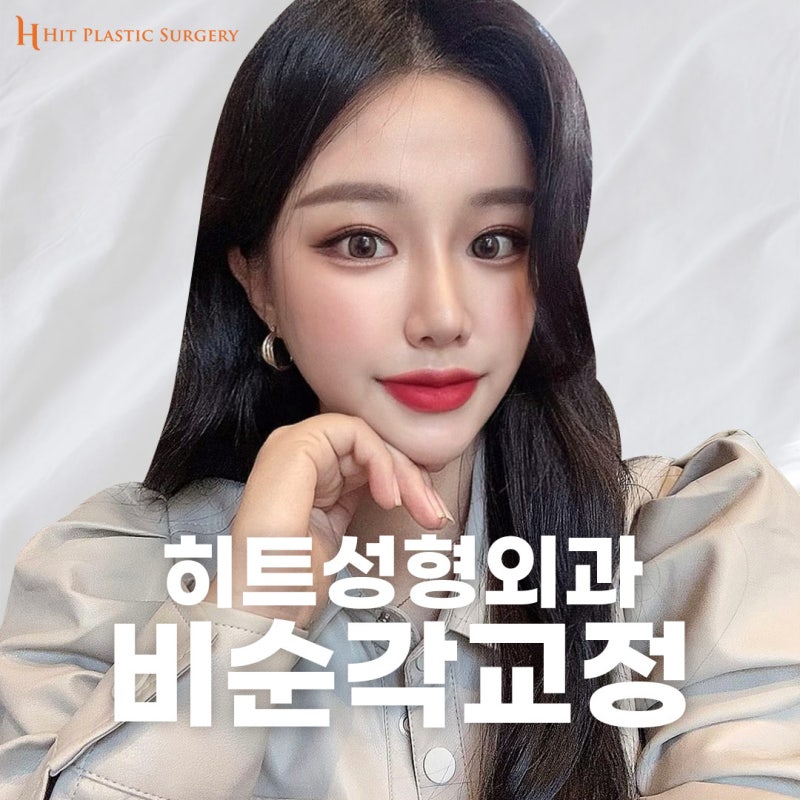 비순각교정 중요한 이유 [히트성형외과]