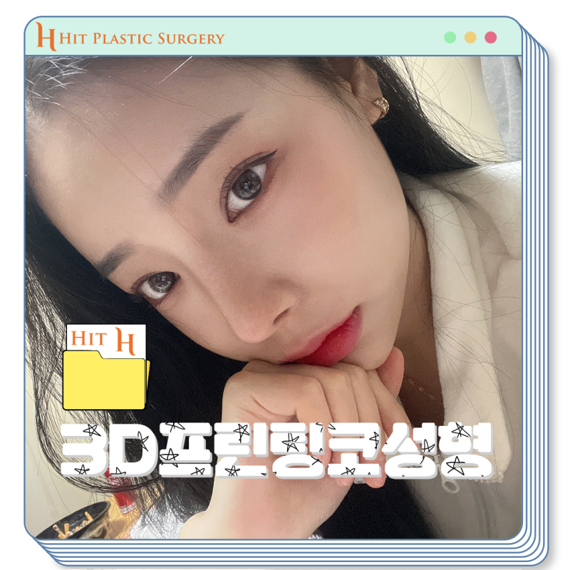 3D프린팅코성형으로 내 코에 딱 맞게 하자!