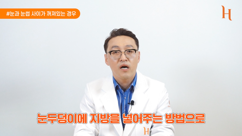 내시경이마거상 하면 안되는 이유 사진 10