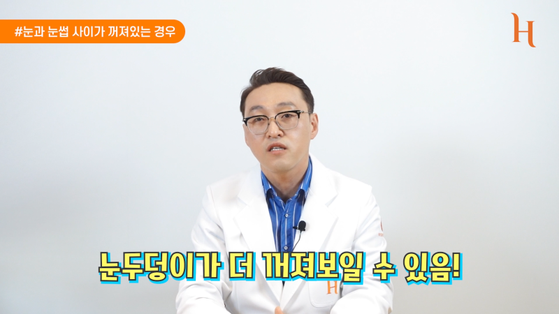 내시경이마거상 하면 안되는 이유 사진 9