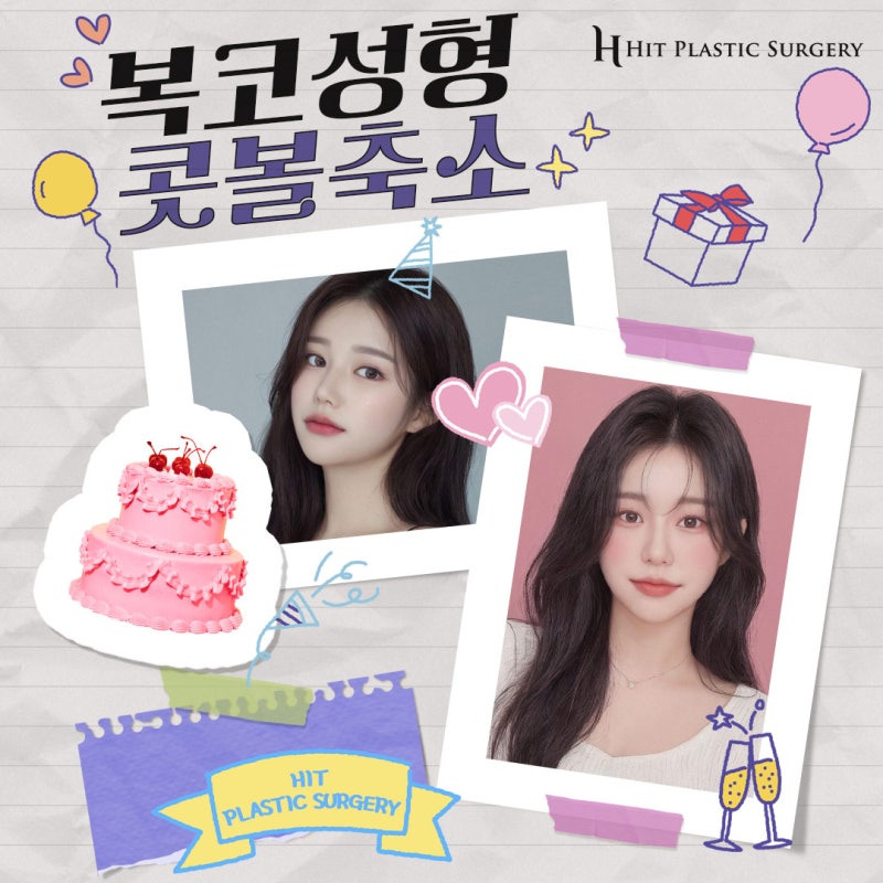 복코성형 콧볼축소만 해도 효과적 [히트성형외과]