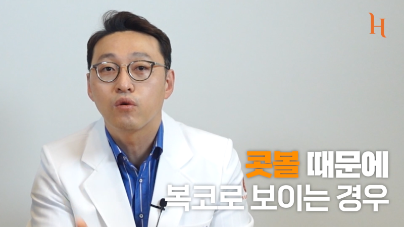 복코성형 콧볼축소만 해도 효과적 [히트성형외과]