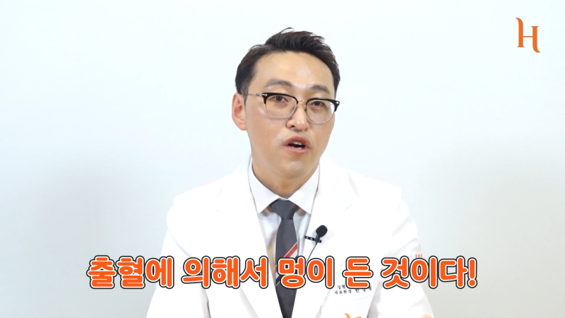 이마거상후기에서 많이 본 멍, 그리고 멍드는 이유 사진 3