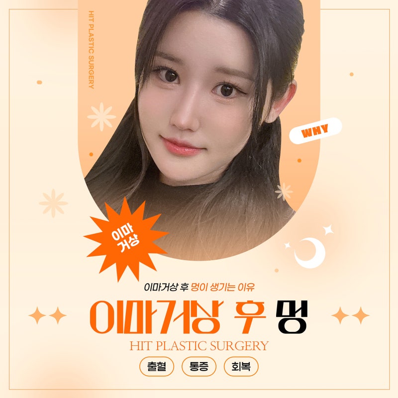 이마거상후기에서 많이 본 멍, 그리고 멍드는 이유