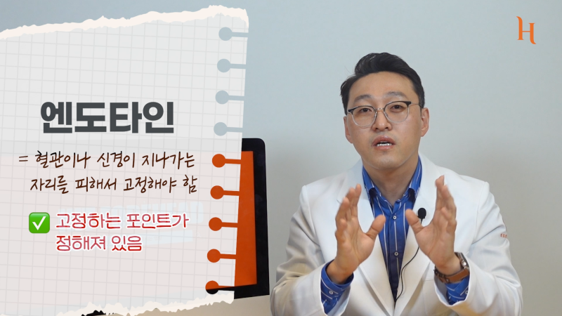 내시경이마거상술 수술방법 2가지 사진 12