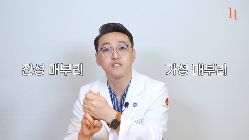 매부리코도 자라난다? 메부리 원인 사진 6