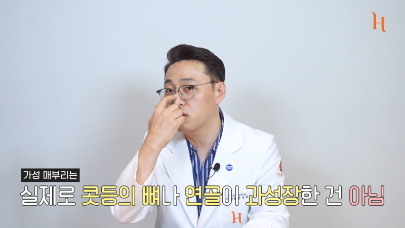매부리코도 자라난다? 메부리 원인 사진 12